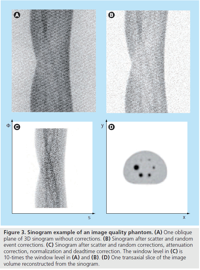 imaging-in-medicine-sinogram-corrections