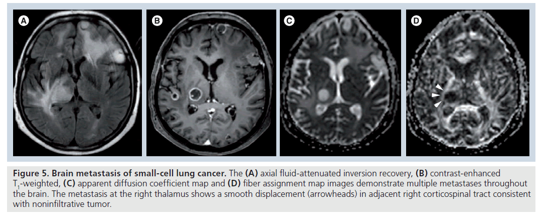 imaging-in-medicine-small-cell