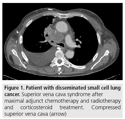 imaging-in-medicine-small-cell