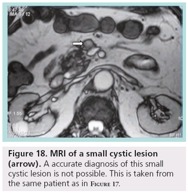 imaging-in-medicine-small-cystic