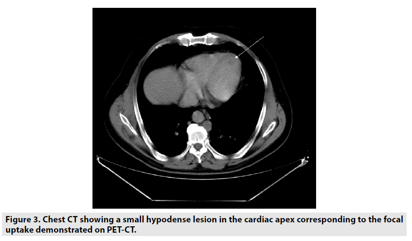 imaging-in-medicine-small-hypodense