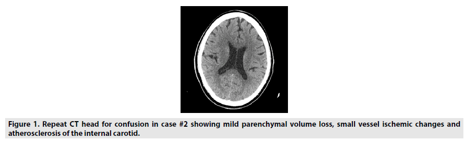 imaging-in-medicine-small-vessel