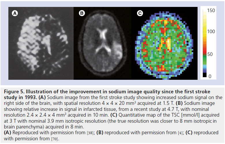 imaging-in-medicine-sodium-image