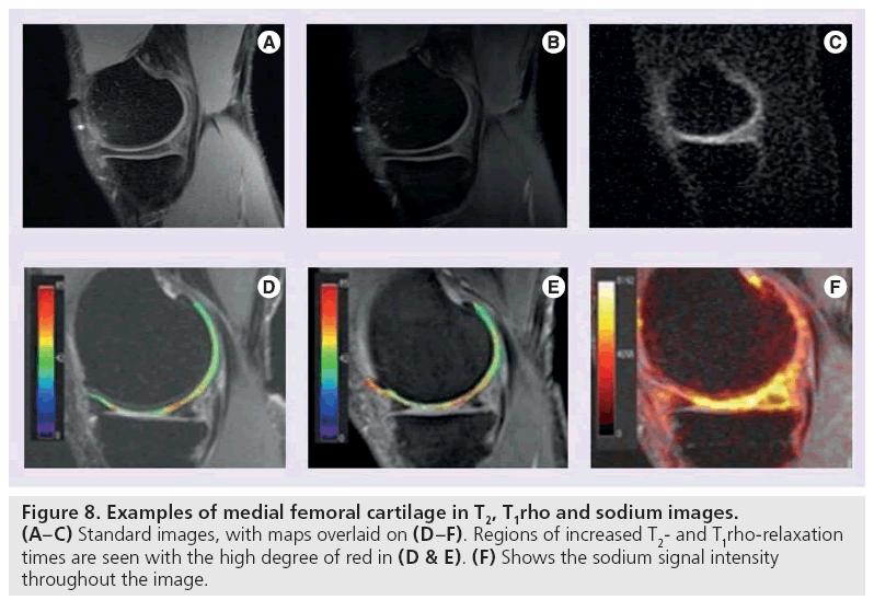 imaging-in-medicine-sodium-images