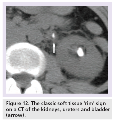 imaging-in-medicine-soft-tissue