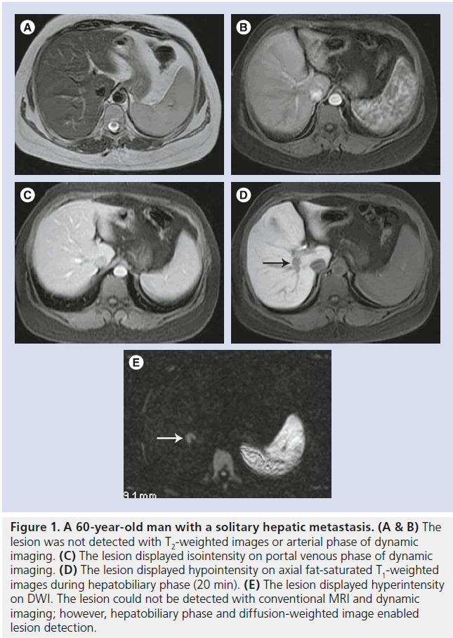 imaging-in-medicine-solitary-hepatic