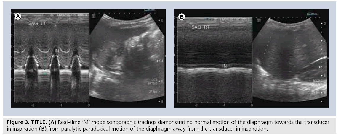 imaging-in-medicine-sonographic-tracings