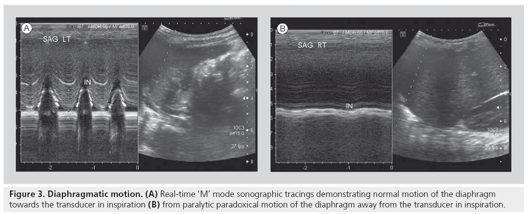 imaging-in-medicine-sonographic-tracings