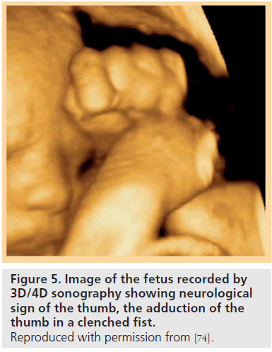 imaging-in-medicine-sonography-neurological