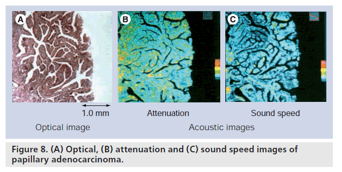 imaging-in-medicine-sound-speed