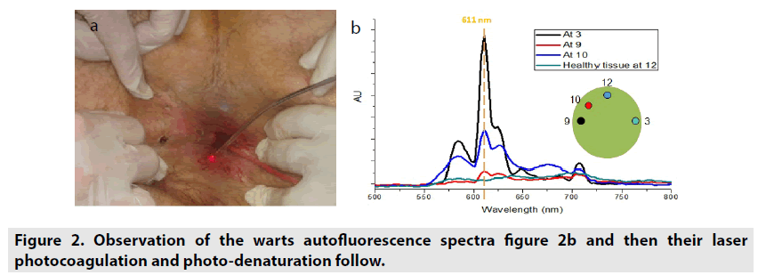 imaging-in-medicine-spectra-figure