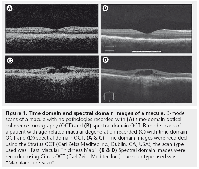 imaging-in-medicine-spectral-domain