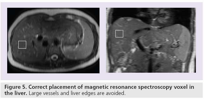 imaging-in-medicine-spectroscopy-voxel