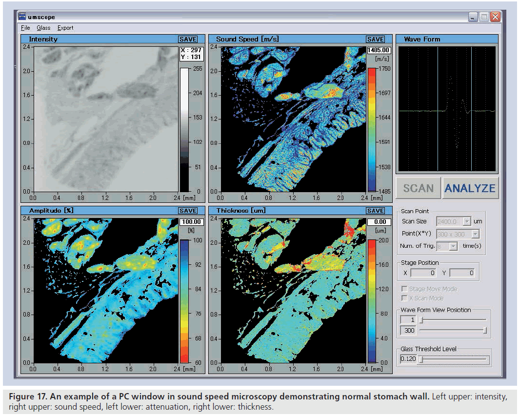 imaging-in-medicine-speed-microscopy