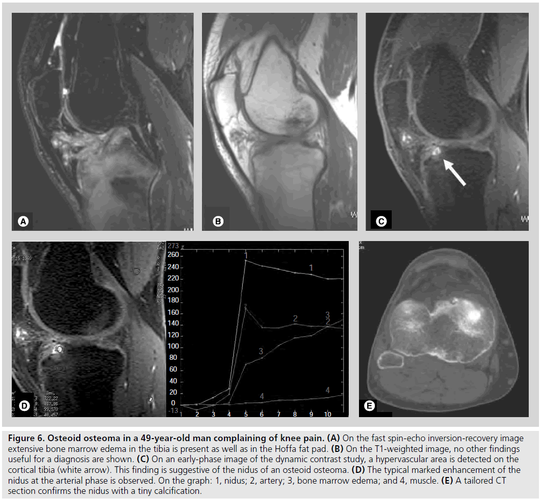 imaging-in-medicine-spin-echo
