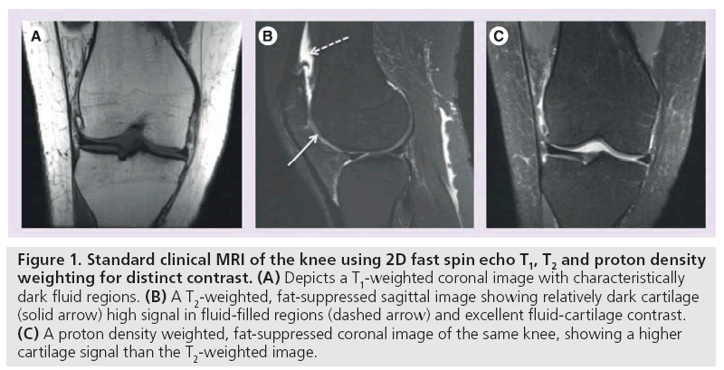 imaging-in-medicine-spin-echo