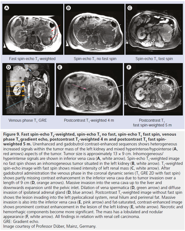 imaging-in-medicine-spin-echo