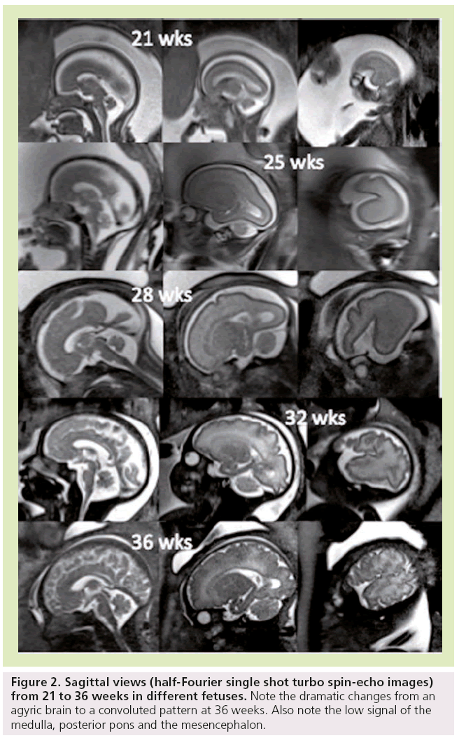 imaging-in-medicine-spin-echo