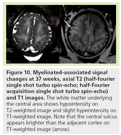 imaging-in-medicine-spin-echo