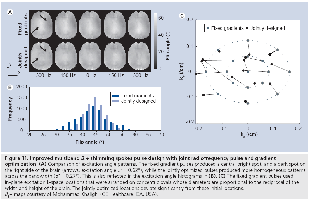 imaging-in-medicine-spokes-pulse