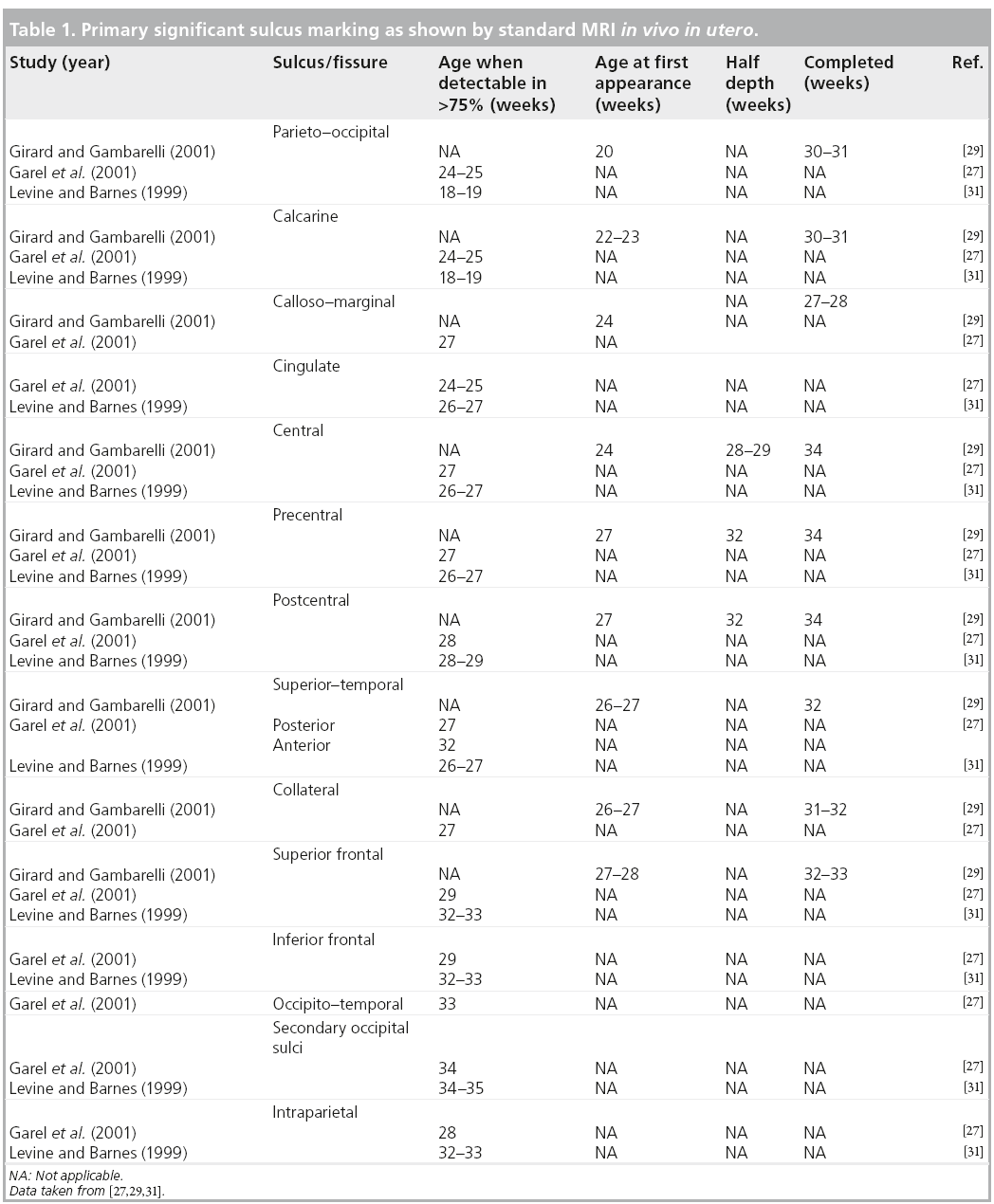 Table