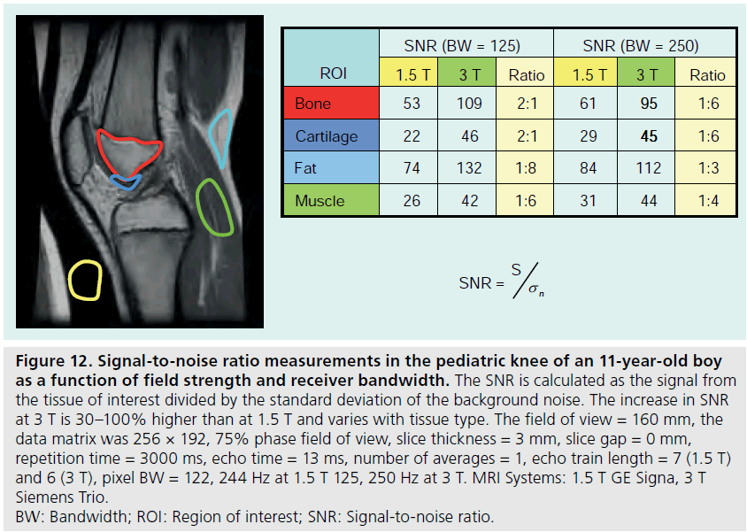 imaging-in-medicine-standard-deviation