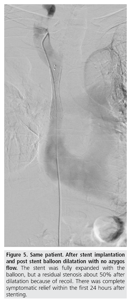 imaging-in-medicine-stent-implantation