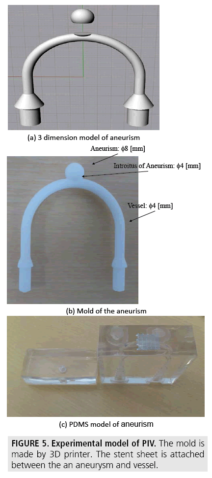 imaging-in-medicine-stent-sheet