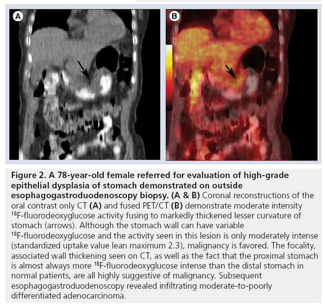 imaging-in-medicine-stomach-demonstrated