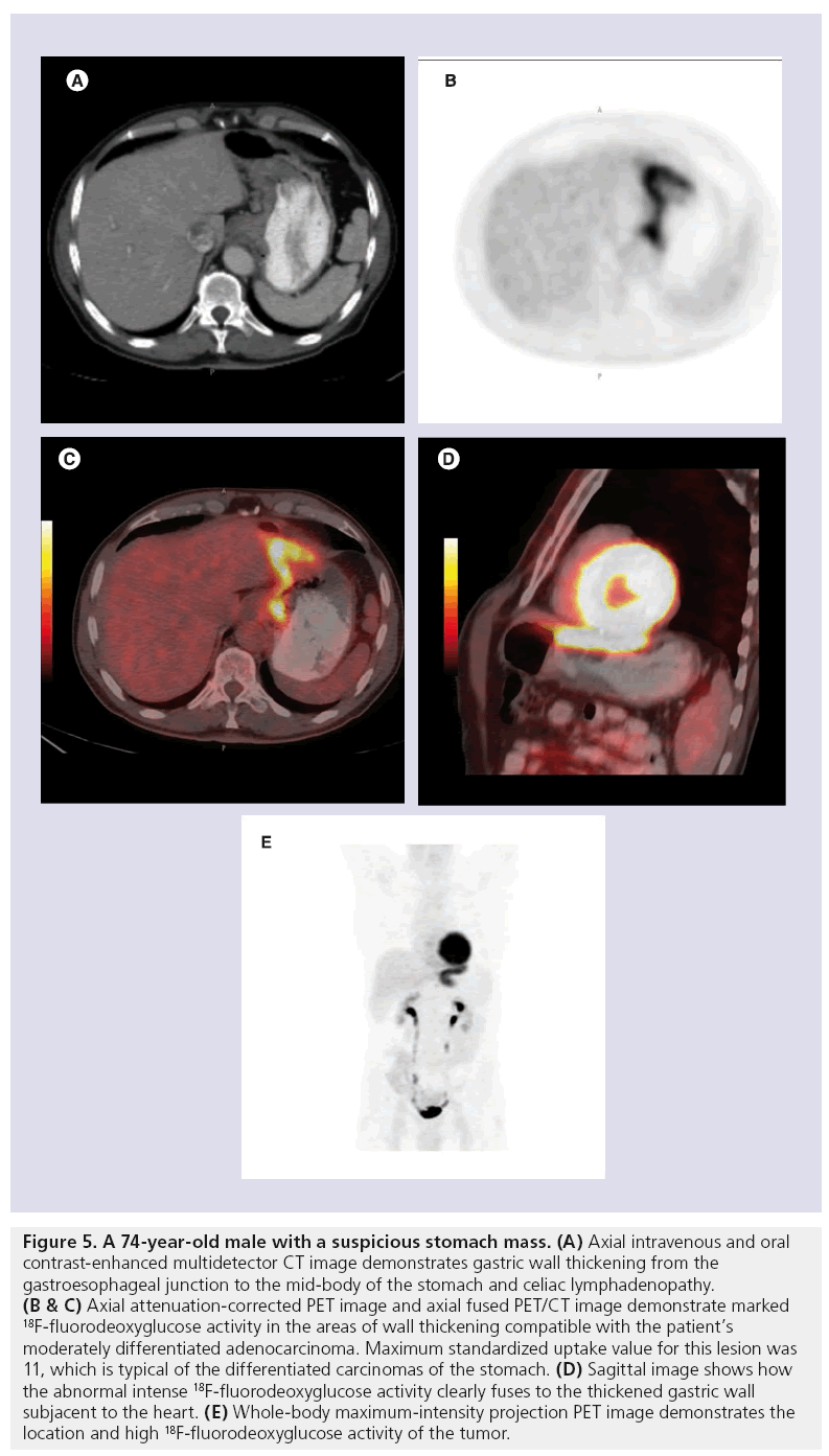 imaging-in-medicine-stomach-mass