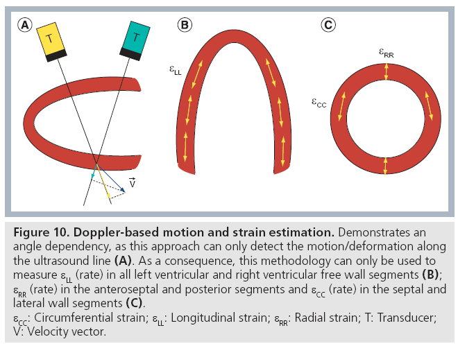 Principles and Practical Aspects of Strain Echocardiography