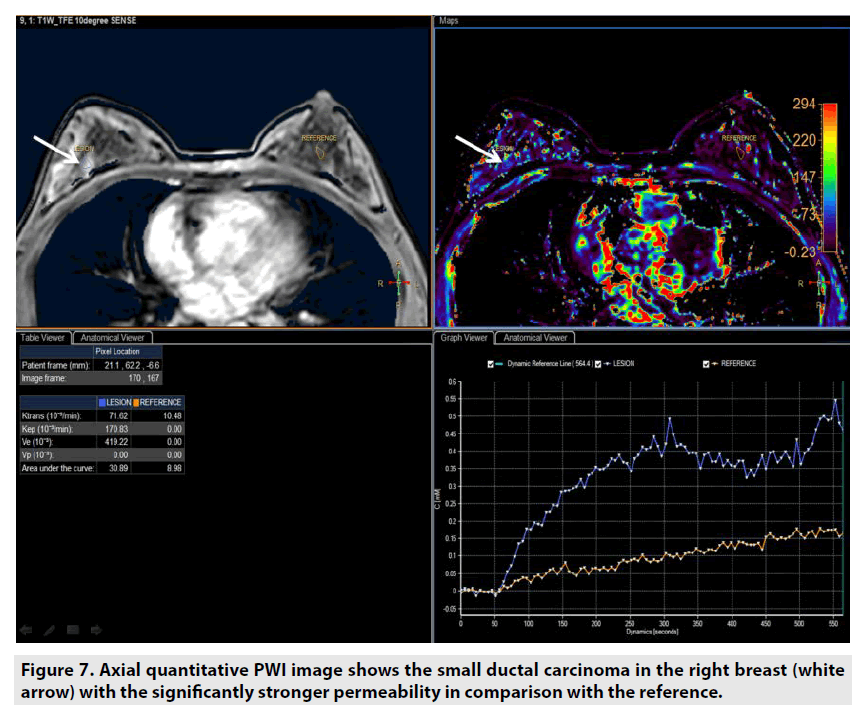 imaging-in-medicine-stronger-permeability