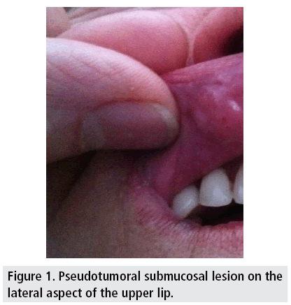 imaging-in-medicine-submucosal