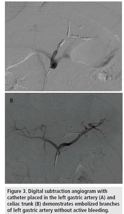 imaging-in-medicine-subtraction-angiogram