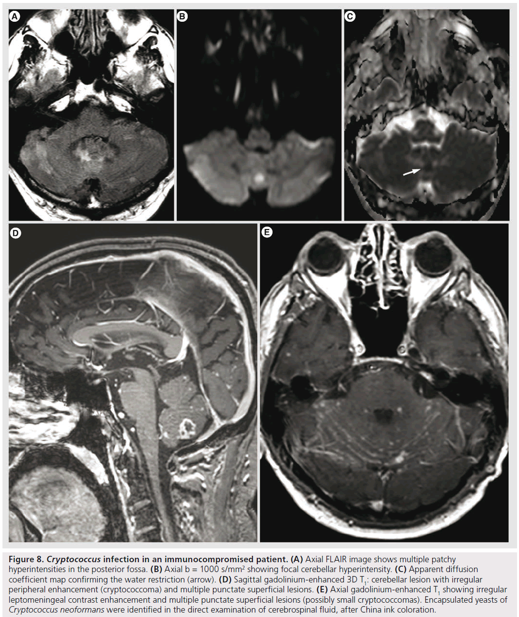 imaging-in-medicine-superficial-lesions