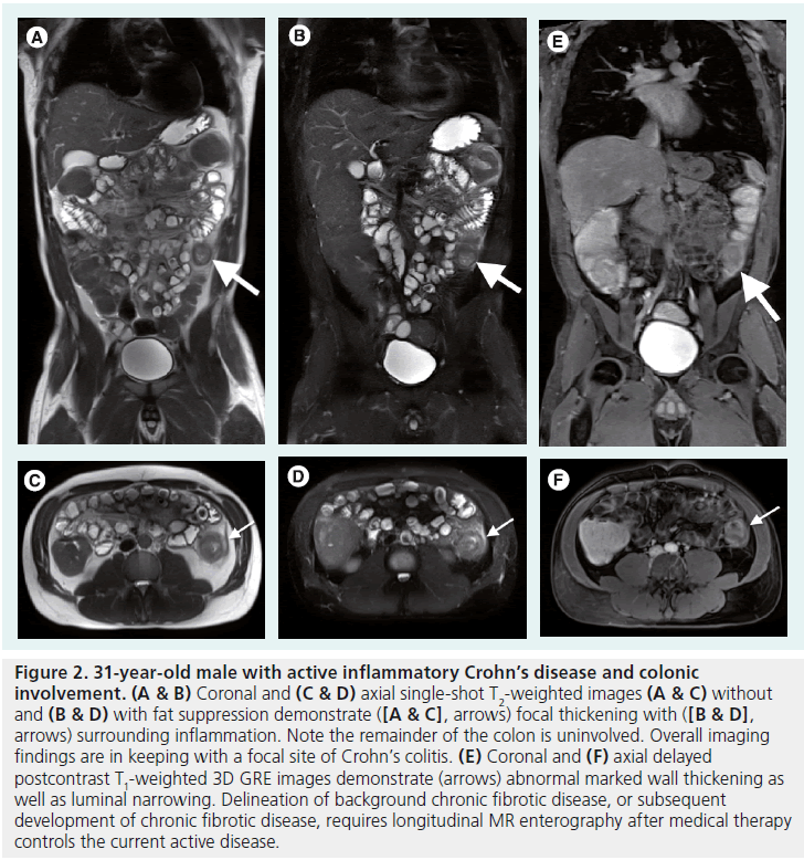 imaging-in-medicine-suppression-demonstrate