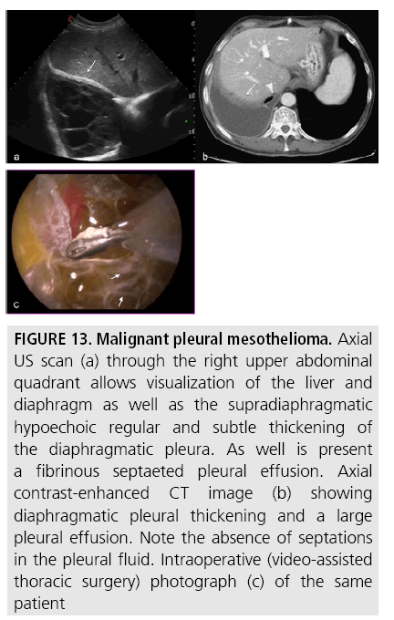 imaging-in-medicine-supradiaphragmatic