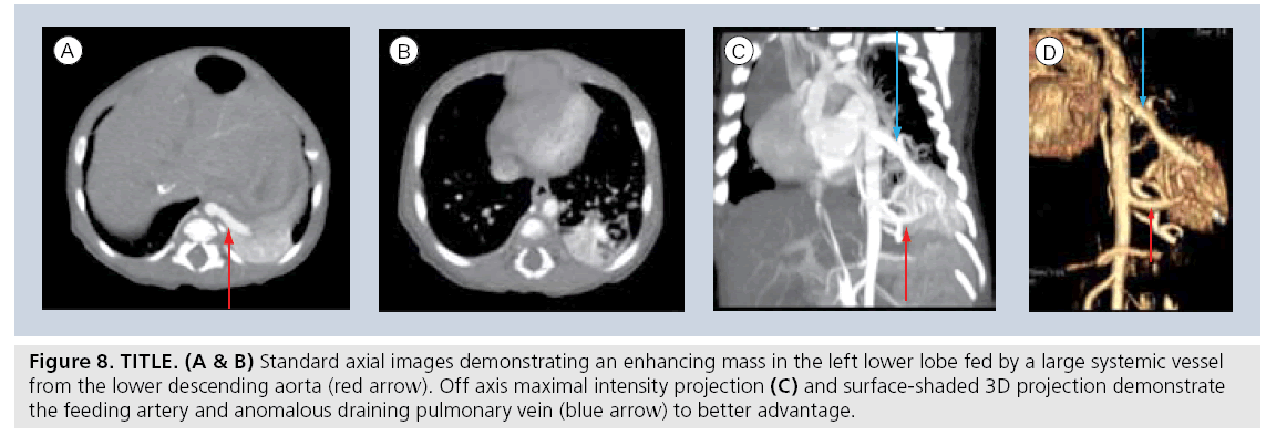 imaging-in-medicine-surface-shaded