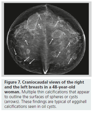 imaging-in-medicine-surfaces-spheres