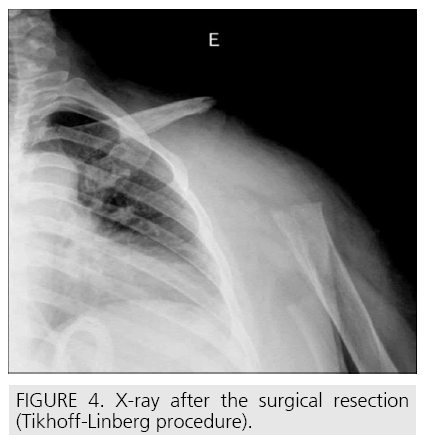 imaging-in-medicine-surgical-resection