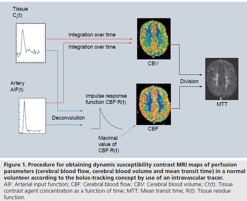 imaging-in-medicine-susceptibility-contrast