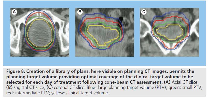 imaging-in-medicine-target-volume
