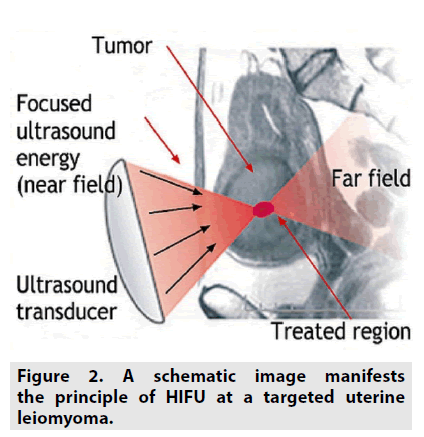 imaging-in-medicine-targeted-uterine
