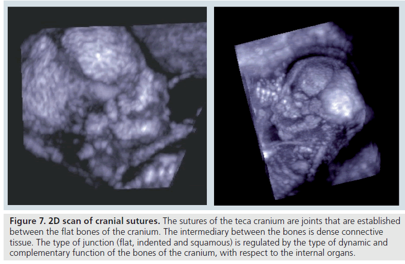 imaging-in-medicine-teca-cranium