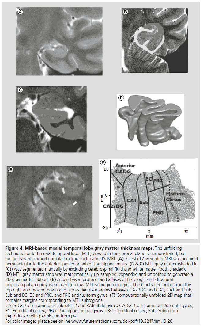 imaging-in-medicine-temporal-lobe