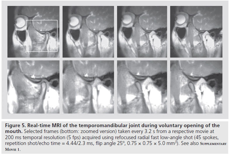 imaging-in-medicine-temporomandibular-joint