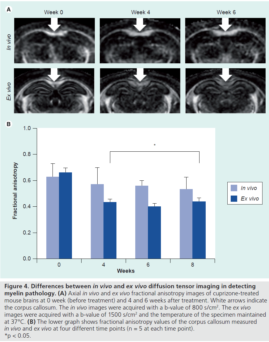 imaging-in-medicine-tensor-imaging