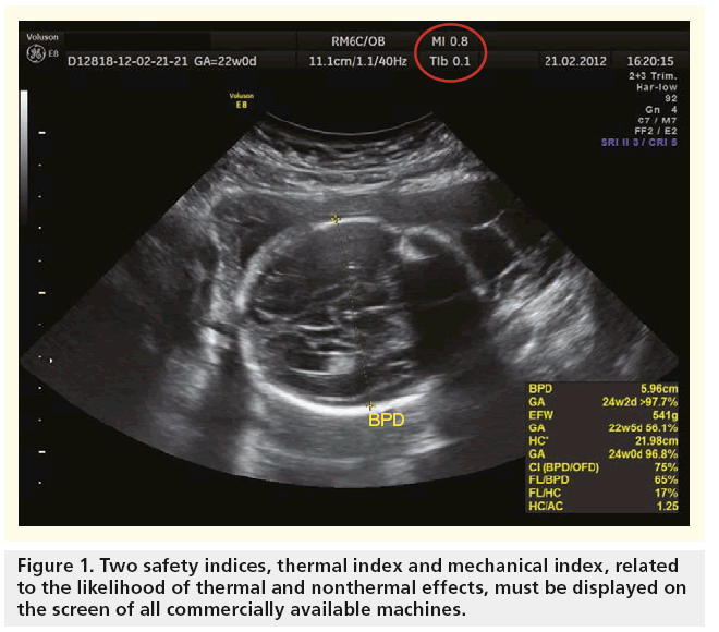 imaging-in-medicine-thermal-index