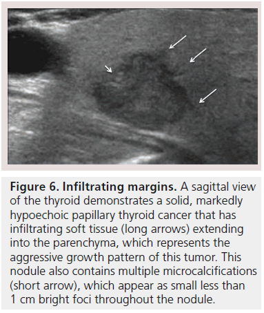 imaging-in-medicine-thyroid-cancer