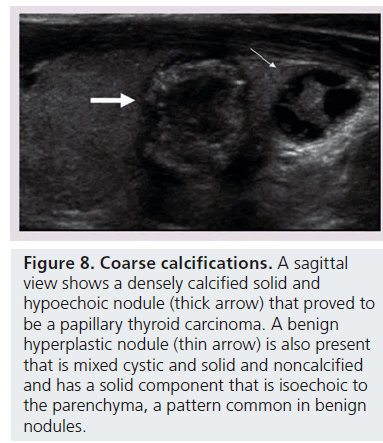 imaging-in-medicine-thyroid-carcinoma